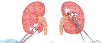 What are the indications that there is a problem in the kidneys